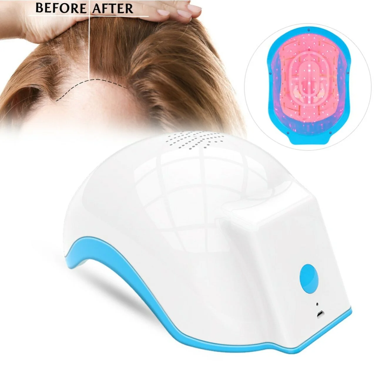 Low-Level-Light-Therapy